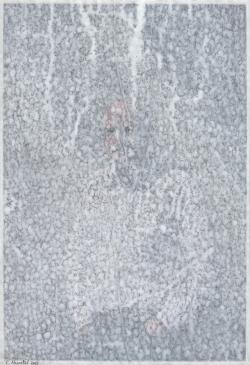 Christian lhopital